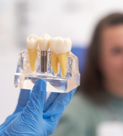 close-up patient listening to a female dentist explaining a dental implant treatment plan. The focus is teeth implant model in dentists hand